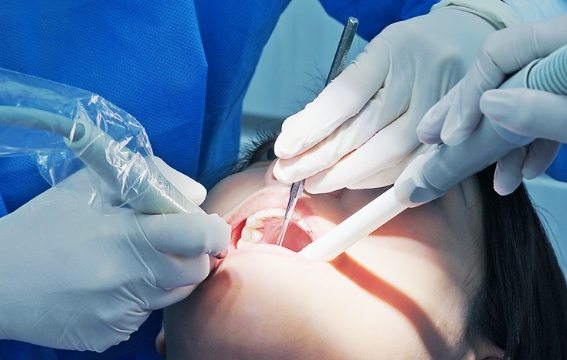 インプラント治療は、今では一般的な歯科治療の選択肢の一つです。